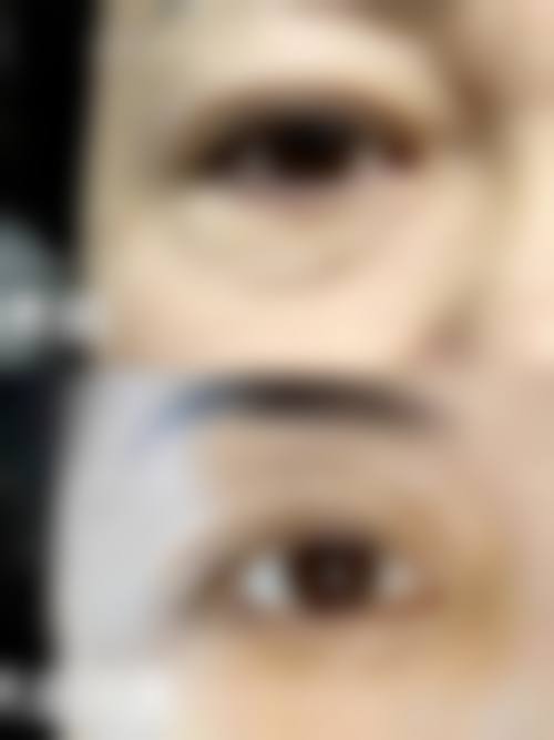 【兴义紫辰辰美整形医院是正规的吗?】