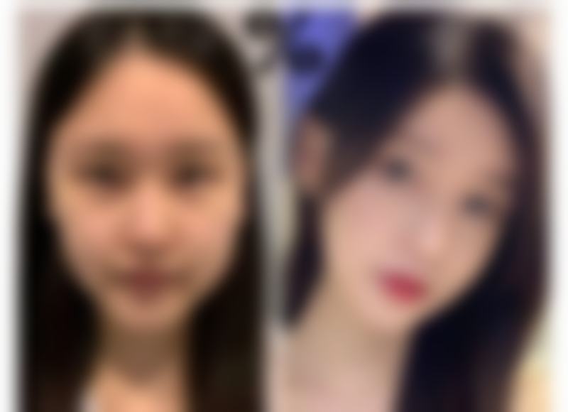 【韩国心动整形医院核心优势:】