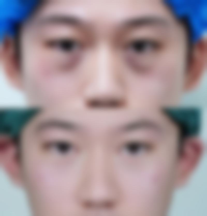 【张严严医生擅长项目】