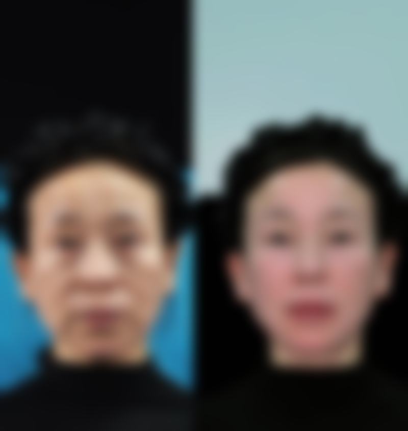 【云南华美美莱整形美容医院参考价格表：】