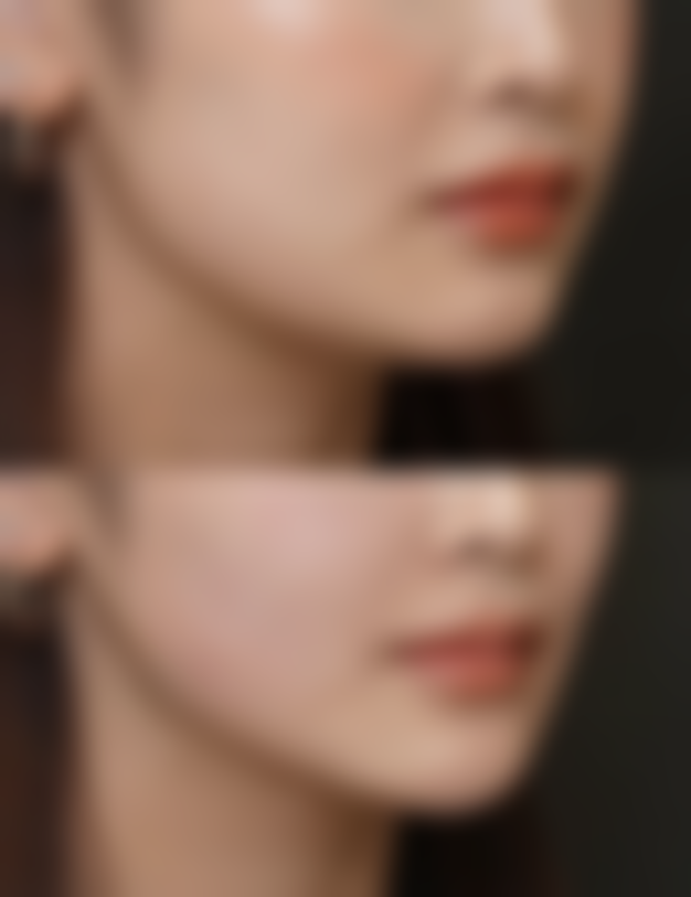 阴道紧缩手术能维持多久