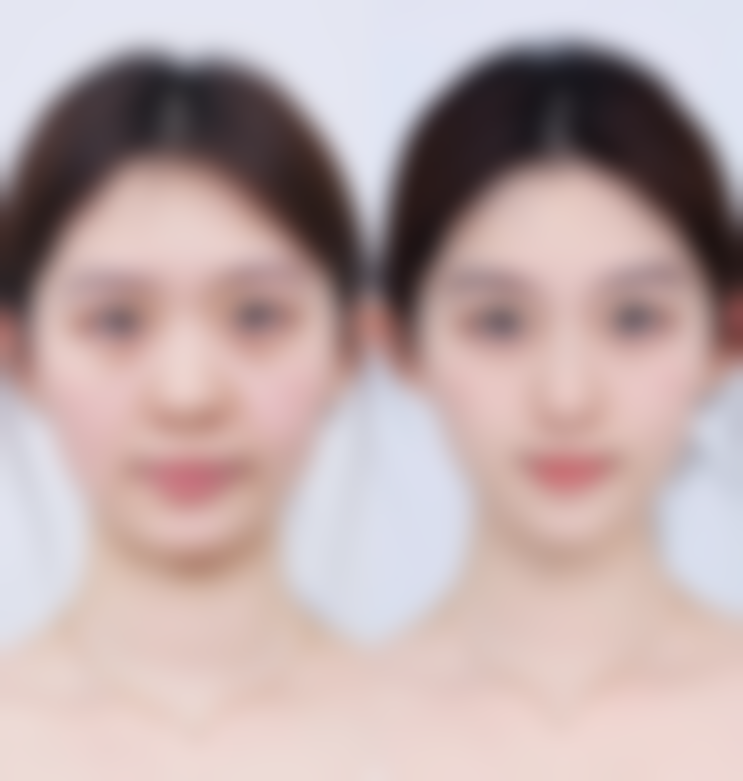 【成都伊姿依美医疗美容诊所参考价格表:】