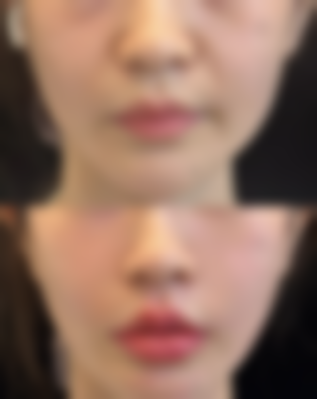 【广州市红十字会医院整形美肤激光中 心是正规的吗?】