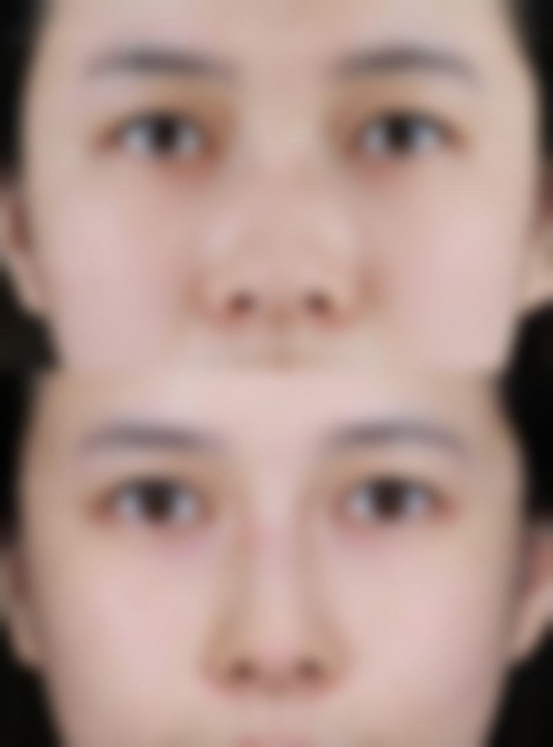 【汕头汕美(华美)医疗美容医院特色项目：】