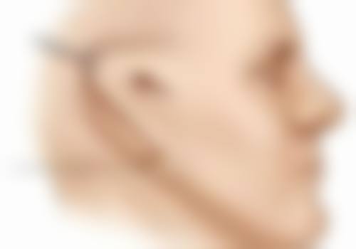 打完瘦脸针多久可以洗脸?