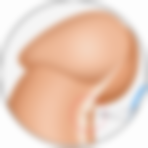 Fotona 4D 的更多功效