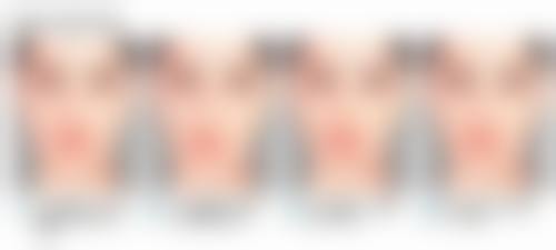 毛发种植后多久开始掉