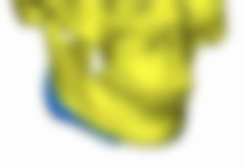 Fotona 4D Pro 激光美容仪评价