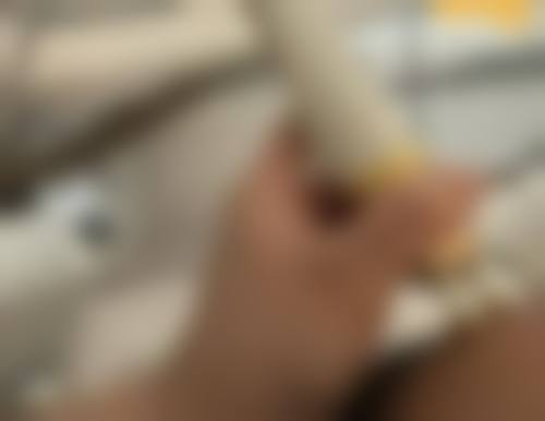 毛发种植的类型