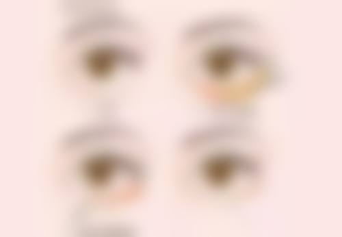 种植发际线多久可以？了解3个关键时间点，术后3个月初步见效果，6个月效果明显！ 