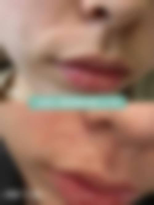 【成都柏悦美合医疗美容怎么预约挂号?】