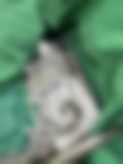 S女性医院李惠妍的超20年医美经验靠谱吗