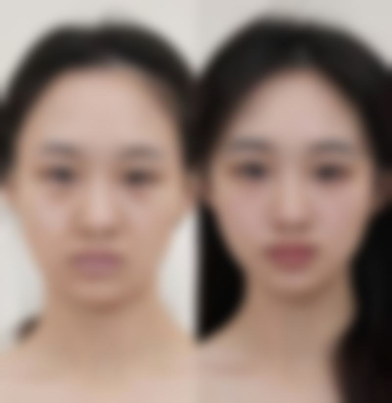 大方脸还有救吗