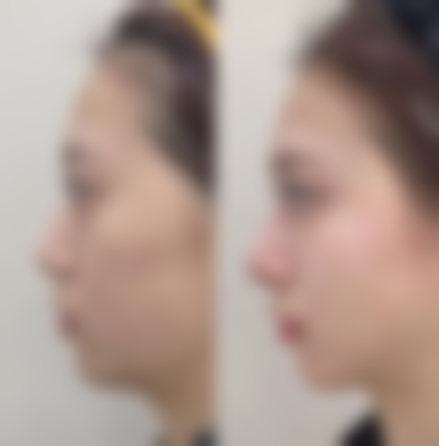 【湖州解放军第98医院医学整形中 心地址:】