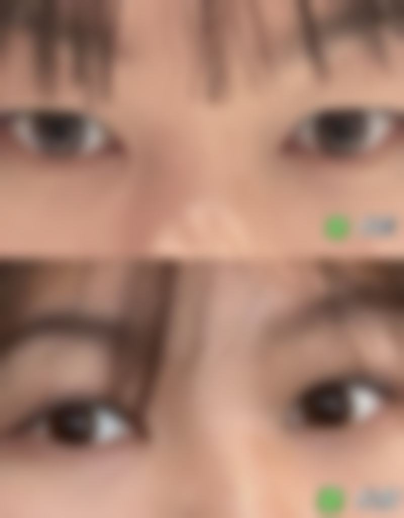 【韩国GRIDA整形外科医院是正规的吗?】