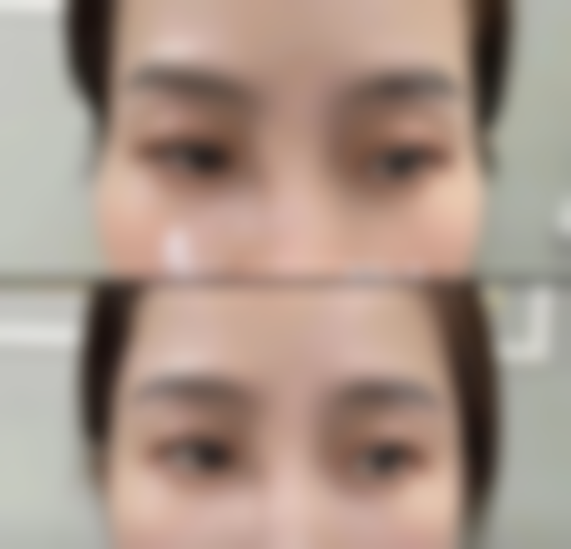 【上海玺美整形医院特色项目：】