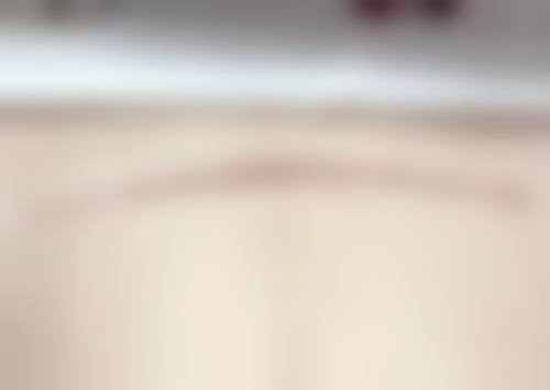 【郑州瑞蓝美容医院患者口碑评价：】