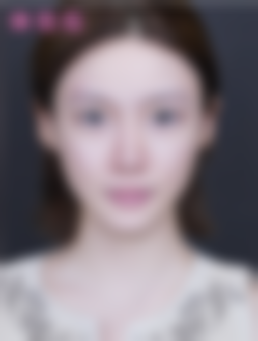 北京米兰柏羽丽都医疗美容医院王新灿的技术为何如此受青睐?