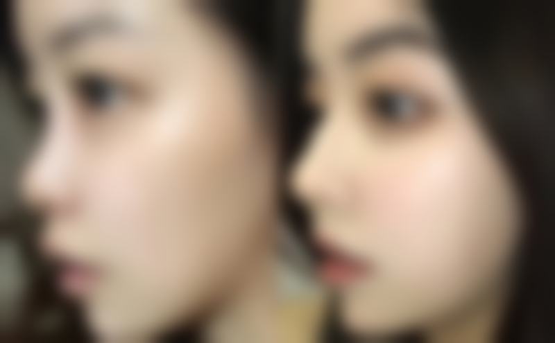 原本没头发的地方能植发吗？