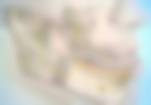 毛发种植是怎么回事？