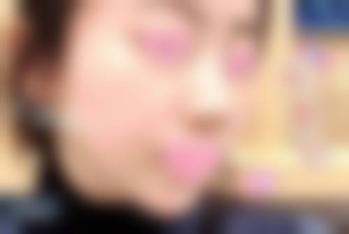 阴道紧缩针多少钱