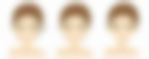 瘦脸针价格及适用人群