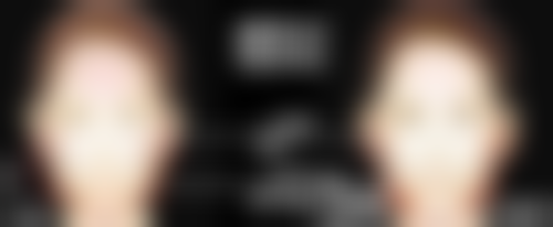 瘦脸针咬肌缩小过程图