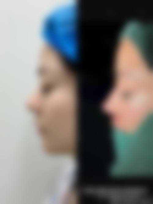 【渼淳玉颜医疗美容参考价格表:】