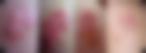 【第四军 医 大学唐都医院整形激光美容中 心参考价格表:】