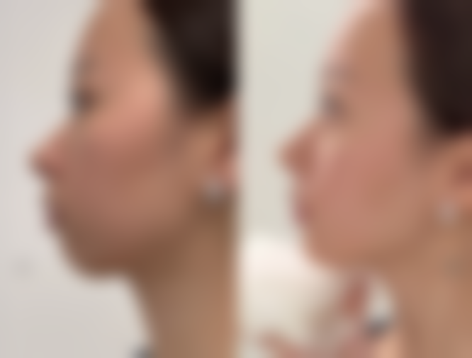 【江南JS医院参考价格表:】