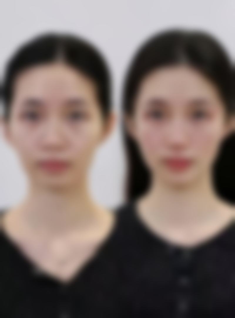 【济南瑞丽整形美容医院参考价格表：】