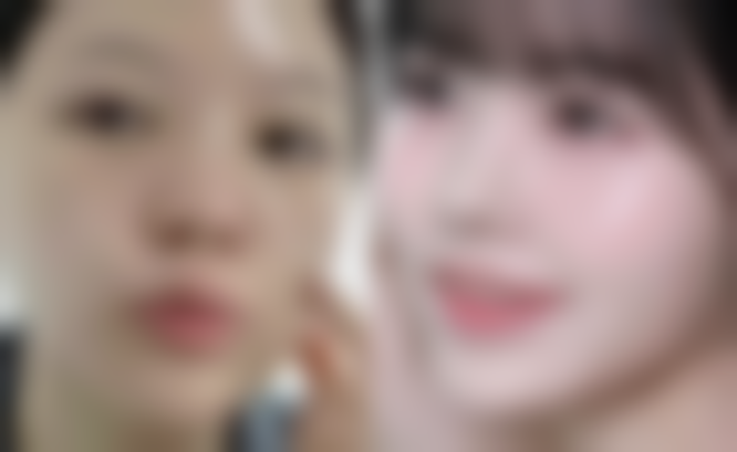 阴道紧缩修复手术能维持多久？答案揭晓！一般2 - 5年，做好这些护理可延长维持时间！ 