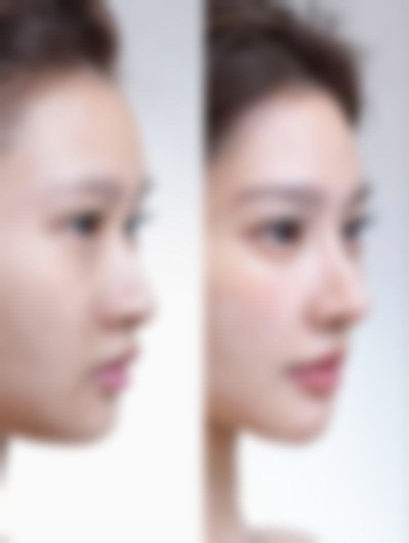 【合肥煜美人整形医院诊疗设备：】