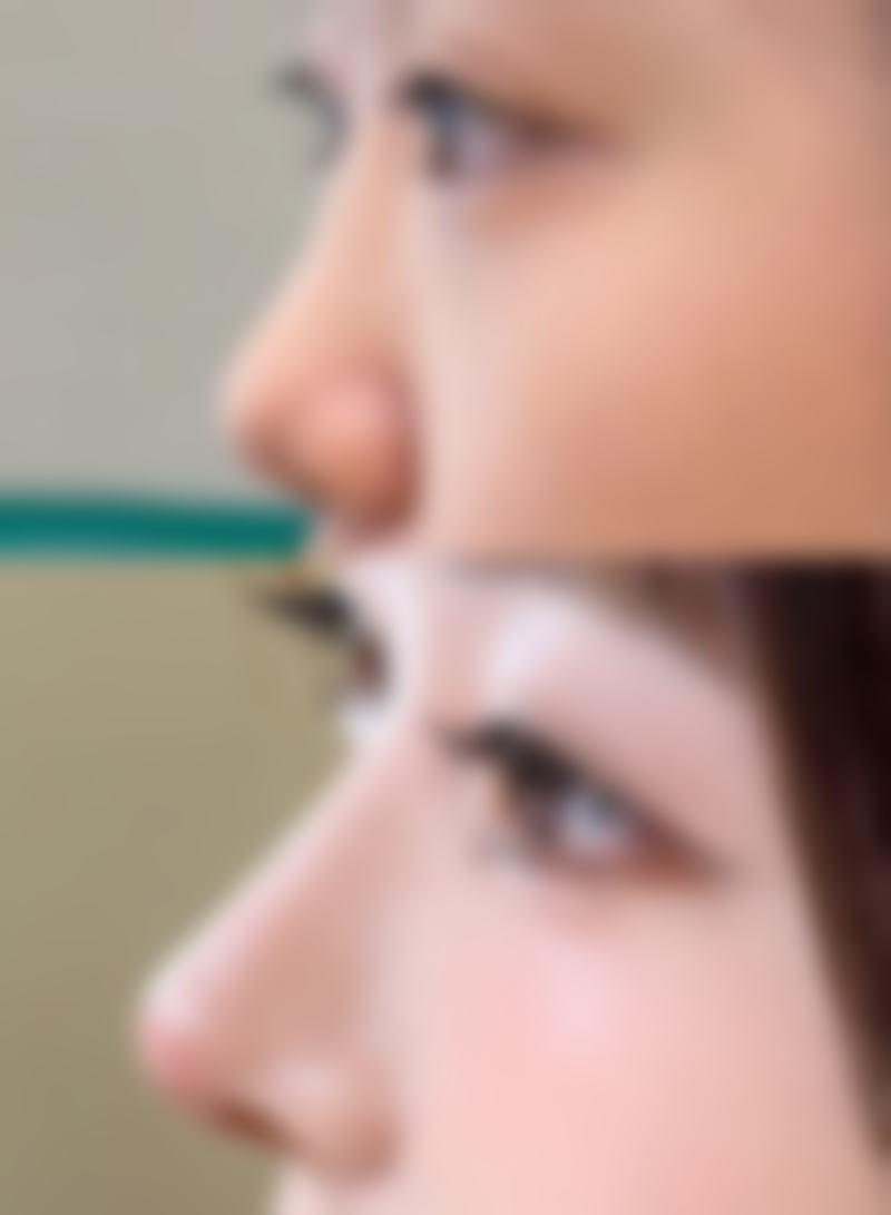 【渼淳玉颜医疗美容诊疗设备:】