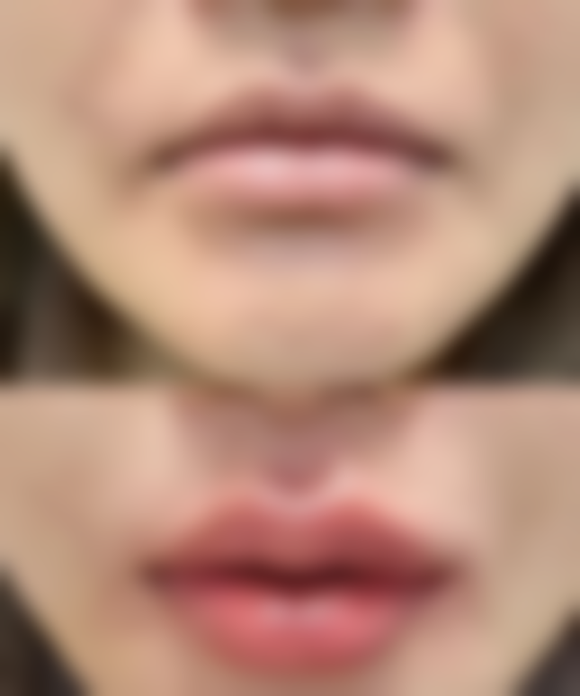 【铜陵市博爱医院美容科特色项目:】