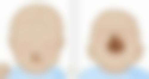 哪些人适合做阴道紧缩手术