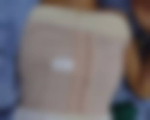 二、除皱针的价格一般是多少