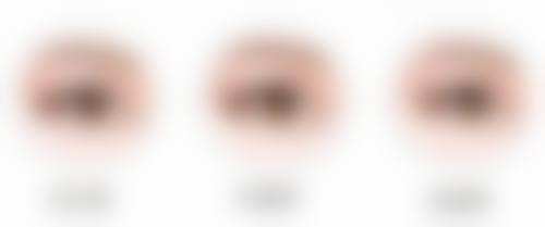 选择瘦脸针品牌的其他注意事项