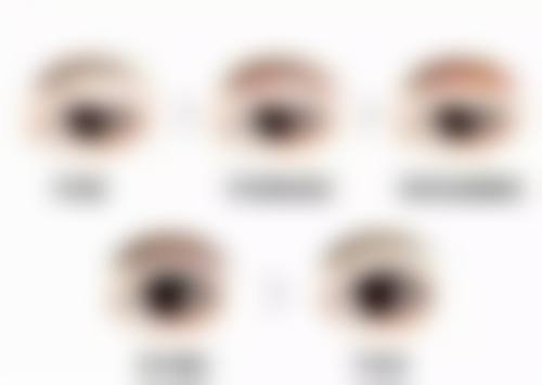 阴道紧缩手术是小手术吗？权威揭秘：成功率超 90%，术后效果显著且恢复快的紧缩术真相！ 