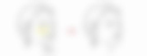 十、除皱针几天见成效