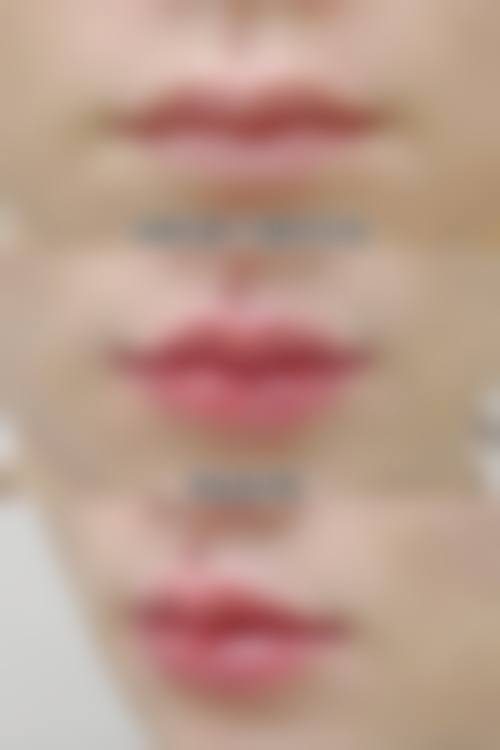 【福州添媛美整形医院特色项目:】