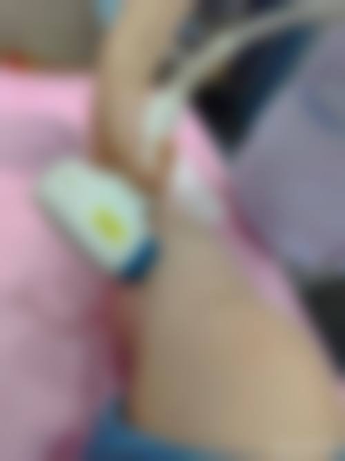 【邓娟娟医生擅长项目：】