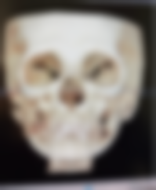 【福州市非常好医院地址:】