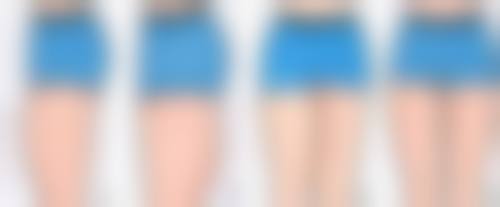 毛发种植手术过程