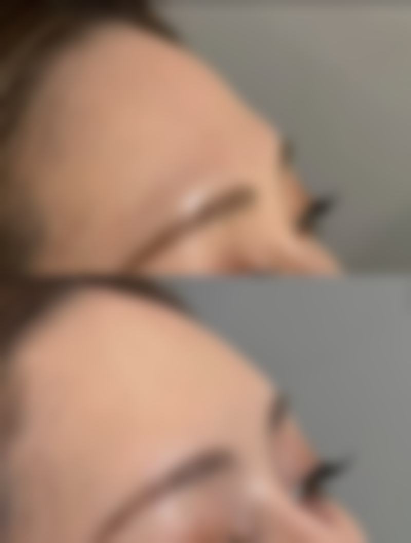 种植毛发手术怎么样啊