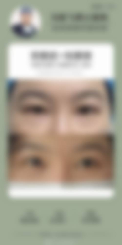 【黔东南穆辰（穆氏）医疗美容整形外科参考价格表：】