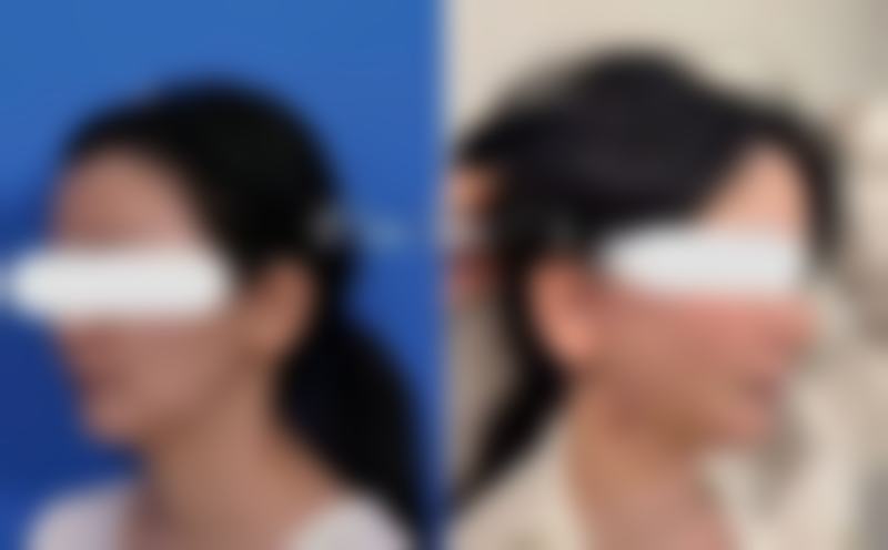 【天津珍妮医疗美容门诊参考价格表:】