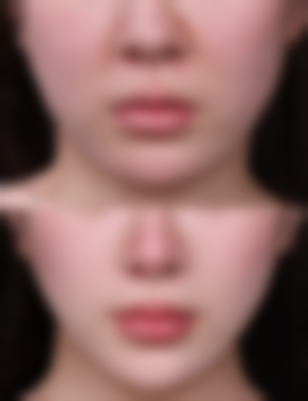 【深圳穆生海美容整形门诊部地址:】