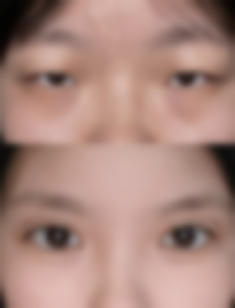 【东莞天瑜整形医院诊疗设备：】