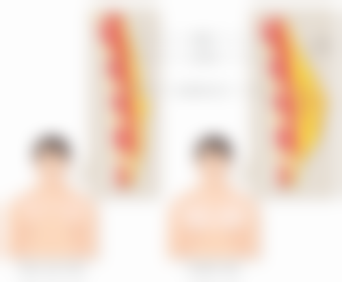 咬肌嘴歪矫正的辅助方法